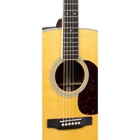 Martin HD-28E Reimagined LR Baggs Anthem